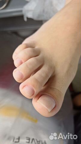 Медицинский педикюр