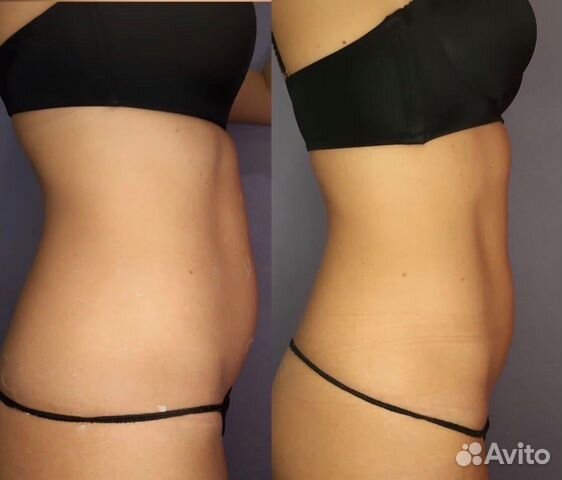 Аппаратная косметология для лица в СПб